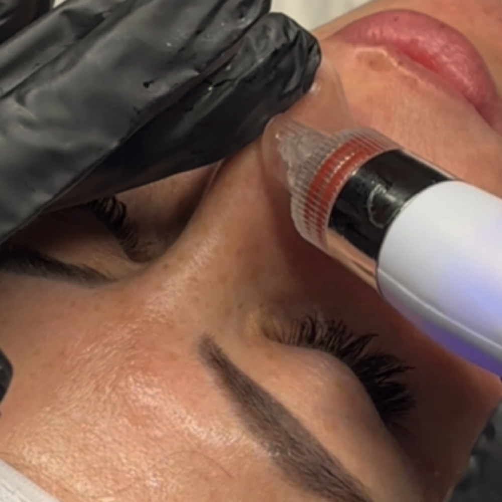 Client review image from Destiny Aesthetics